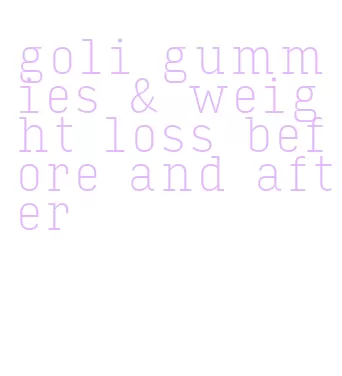 goli gummies & weight loss before and after