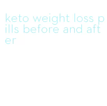 keto weight loss pills before and after