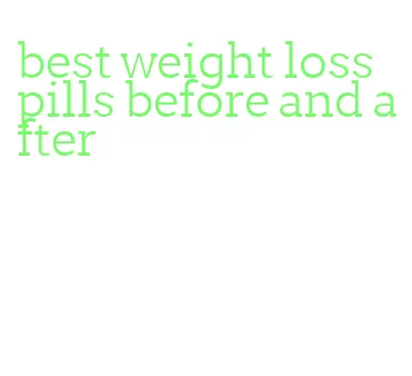best weight loss pills before and after
