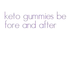 keto gummies before and after